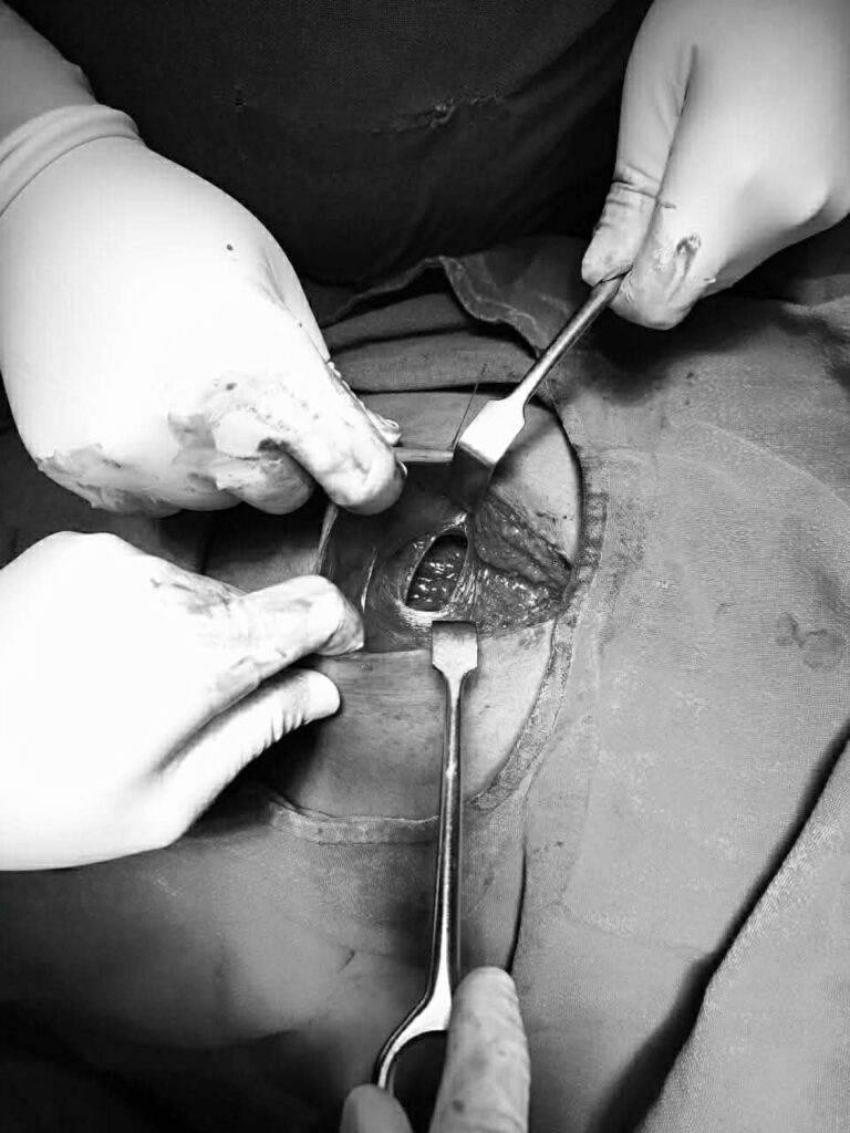 धौलागिरी प्रादेशिक अस्पताल बागलुङले शल्यक्रिया गर्दा लिइएको तस्बिर